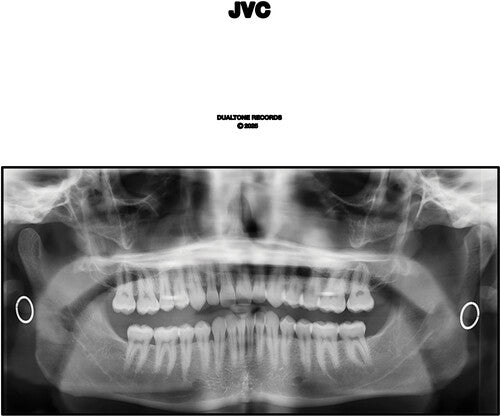 Jack Van Cleaf - Jvc 2LP (Explicit Lyrics, Bonus Tracks) ( VINYL )