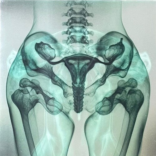 Eartheater - Shark Brain / Dolphin - Glow in the Dark LP (Colored Vinyl, Glow In The Dark) ( VINYL )